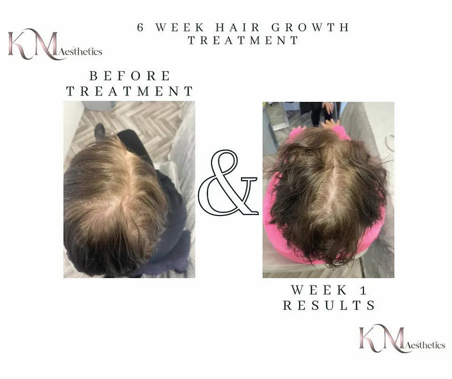 Before and week one hair growth treatment comparison.